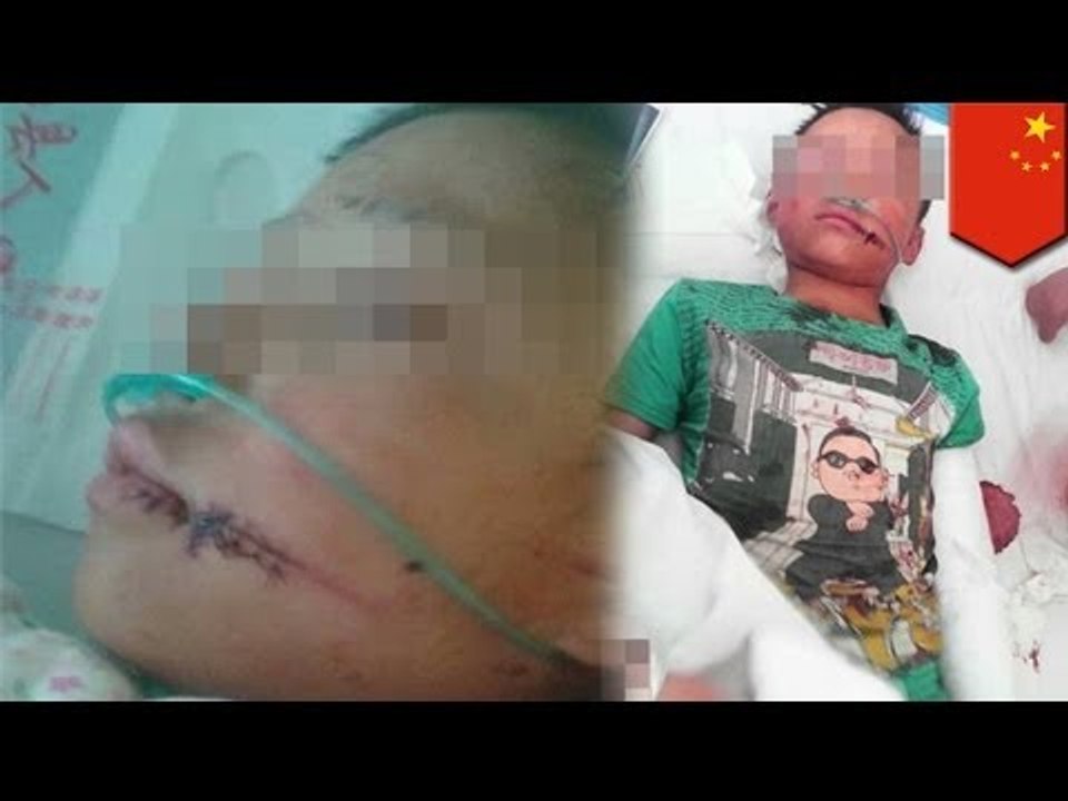 Crazy Child abuse in China: evil stepmother abuses her stepson, left him half dead