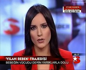Adana'da doğan YILAN BEBEK