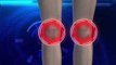 Animation Explains the Science Behind Kylie Jenner's Lips