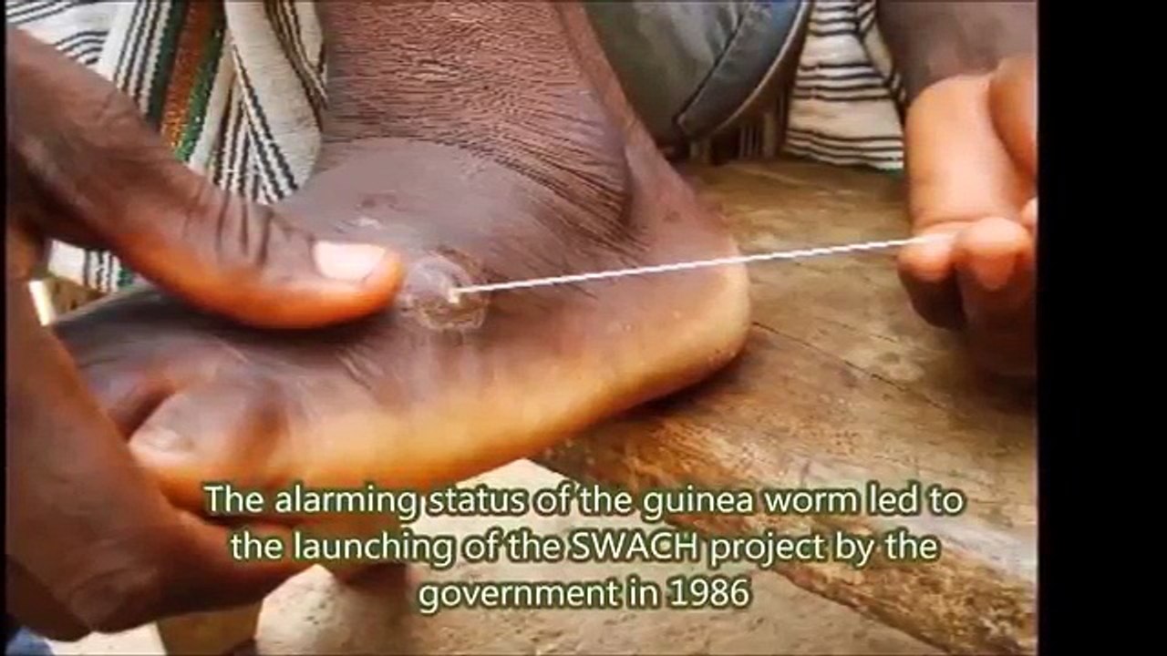 Top_5_Rare_And_Strange_Cases_In__Indian_Medical_History