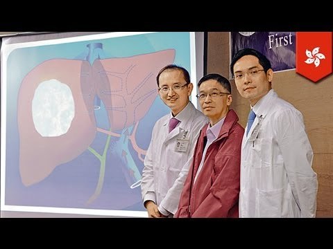 Six liver cancer patients in Hong Kong recover after new form of hepatectomy