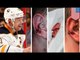 Ehrhoff's incredible NHL ear injury in Philly Flyers vs Buffalo Sabres game