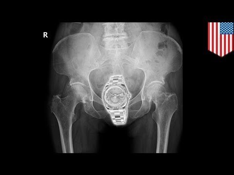 Woman steals $35,000 Rolex and hides it in her lady cave!