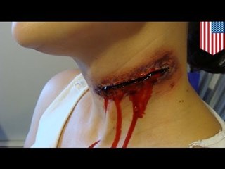 Woman's throat slit by daughter's 15-year-old boyfriend