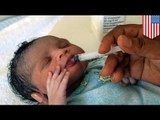 Second US HIV-positive baby cured by early treatment