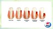 Remedios caseros para las enfermedades de las encias (periodontitis, gingivitis)