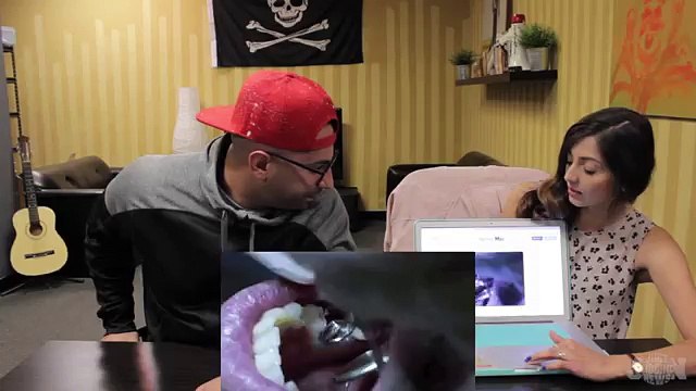 Rugby Players Replace Their Knocked Out Teeth With Bottle Openers ft. fouseyTUBE & David So