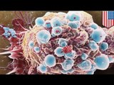 Killer 'sticky balls' may stop cancer spreading