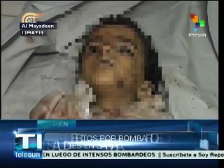 Yemén: 69 muertos por nuevo bombardeo de coalición saudí