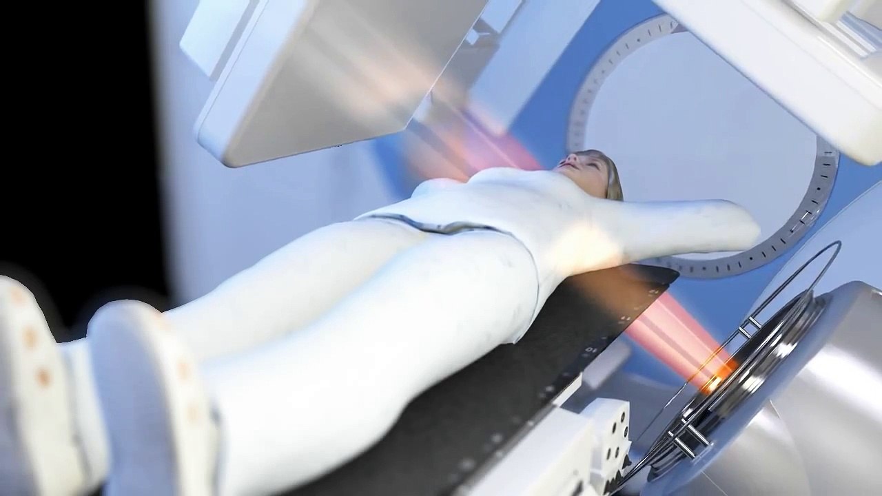 Elekta VMAT Animation in HD