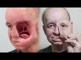 3D列印人皮面具  毀容男幸福重生
