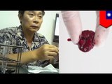 Clinics caught illegally selling virginal blood balls to prostitutes
