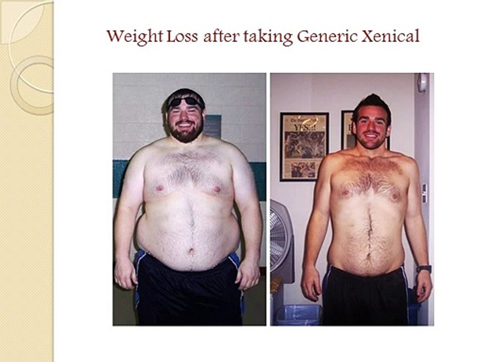 Generic Xenical - Best Weight Loss Pills