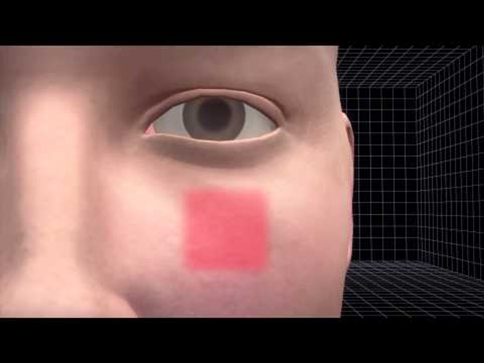 Tooth implanted into the eye to restore vision - video Dailymotion