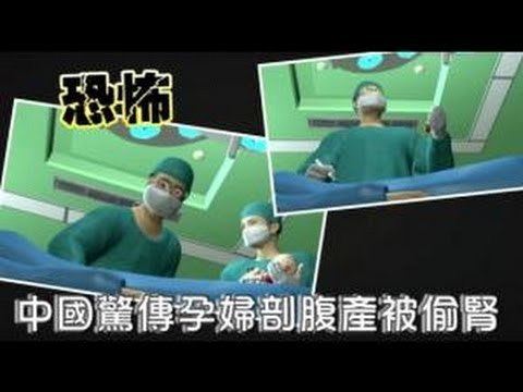 恐怖 中國驚傳孕婦剖腹產被偷腎 2012.08.29