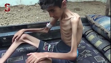 لا حول ولا قوة إلا بالله سدو تدمع له الأعين