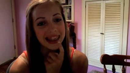 Orthognathic Surgery Video 1 - 1 Month Prior