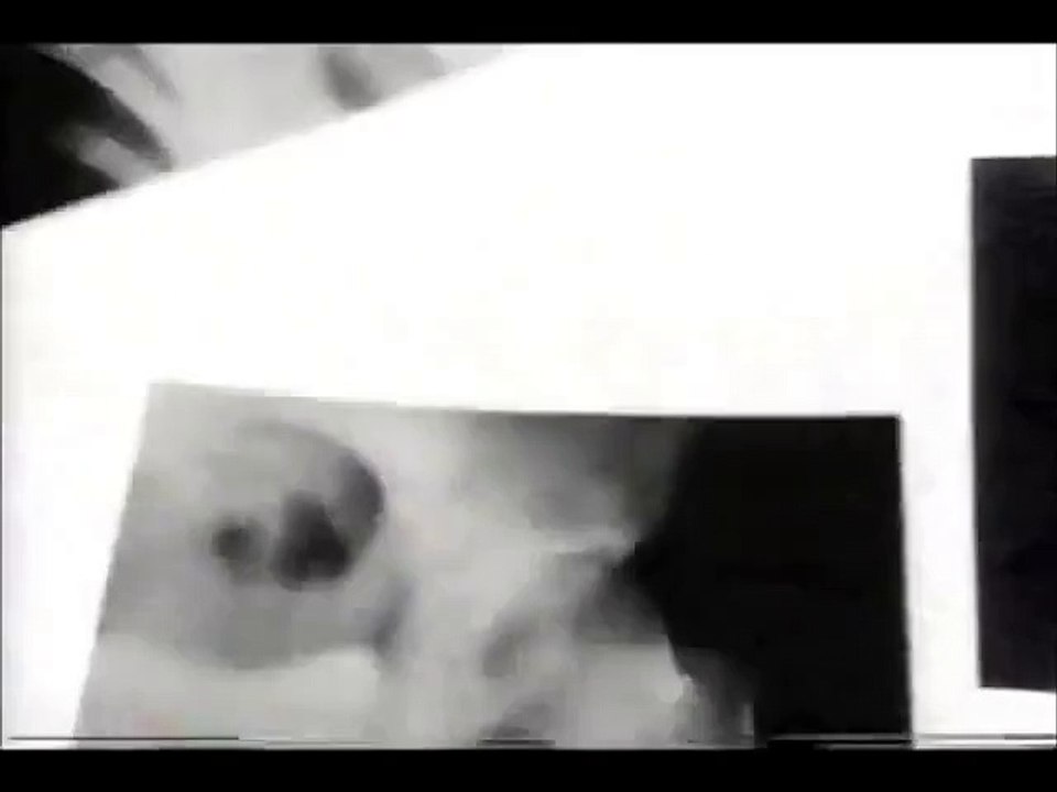 Nuprin  the little yellow different better  1990 commercials