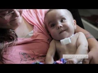 Researchers use 3D printers to save baby's life