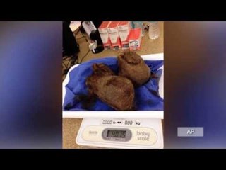 GROSS! Tiger has soccer-ball sized hairball removed from gut!
