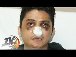 Vhong Navarro, patuloy na humihingi ng hustisya