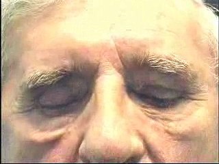 Abnormal eyelid position