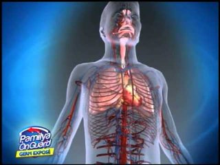 Untreated allergic reactions caused by food can be fatal