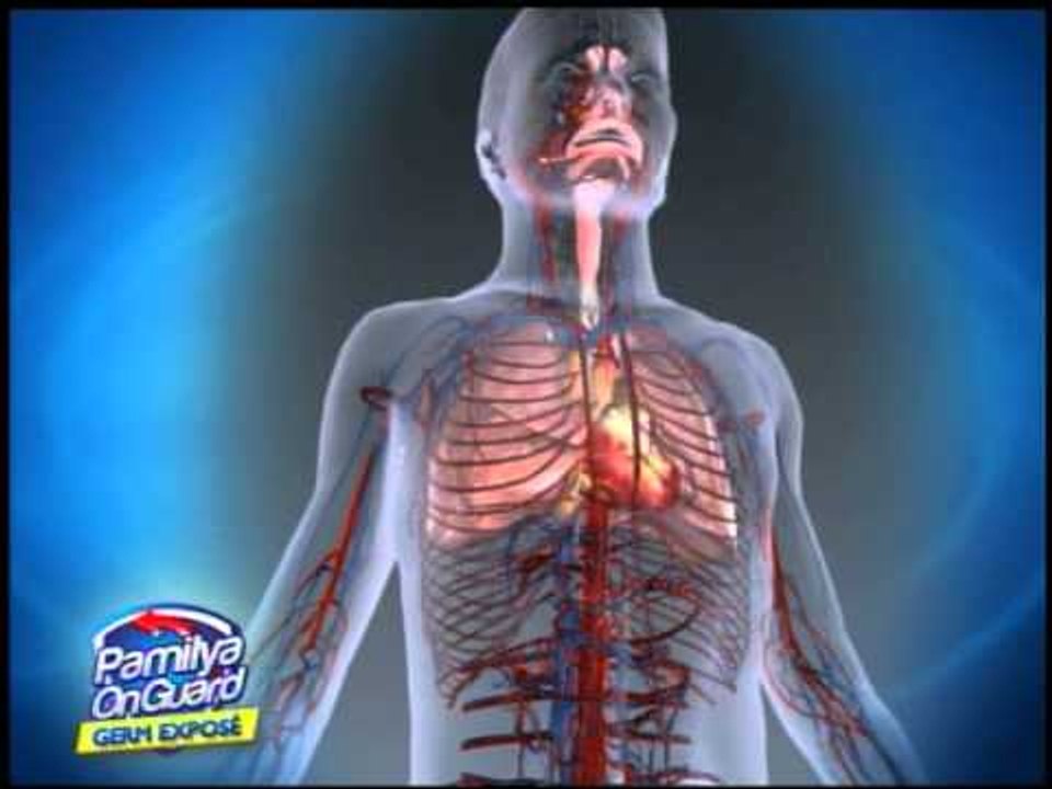 Untreated allergic reactions caused by food can be fatal