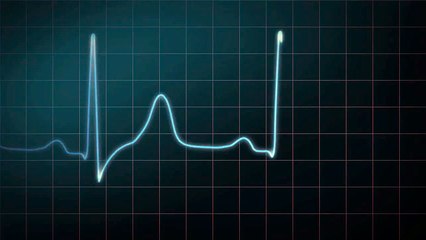 048 How to Read an Electrocardiogram (ECG/EKG)