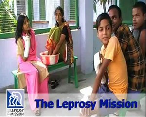 Living with leprosy - Kamless's story