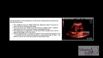 4D Ultrasound in Obstetrics - Congenital Hydronephrosis in 4D Scan