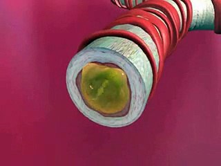 Understand Asthma -The triggers and the sysmptoms of Asthma