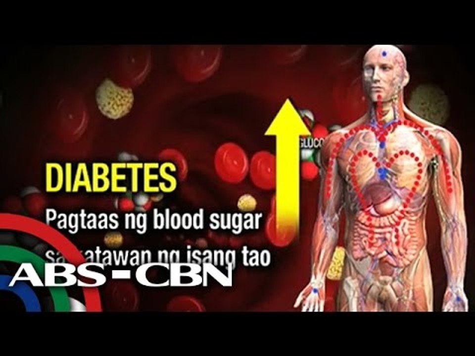 Tips para makaiwas sa diabetes