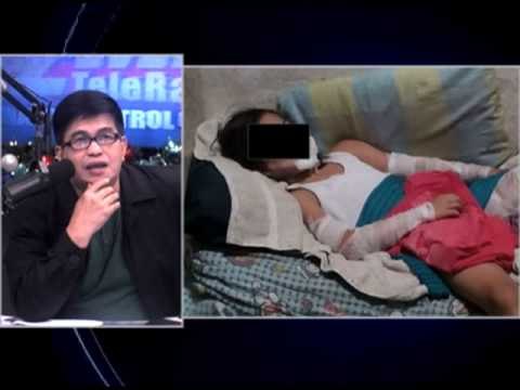 Dad burns daughter with paint thinner