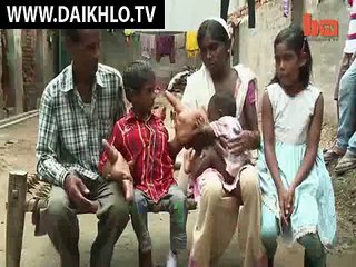 Watch  Mystery Condition Gives Indian Boy Gigantic Hands