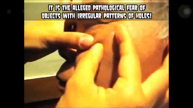 Zits, Popping, Cysts, Skin and. Trypophobia