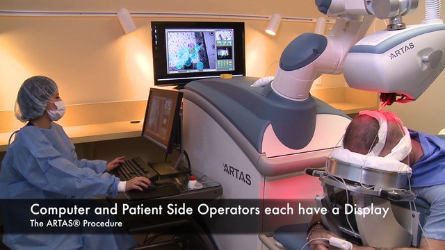 The ARTAS Procedure - ARTAS Software Version 4_8_2 - VO (1920 x 1080)