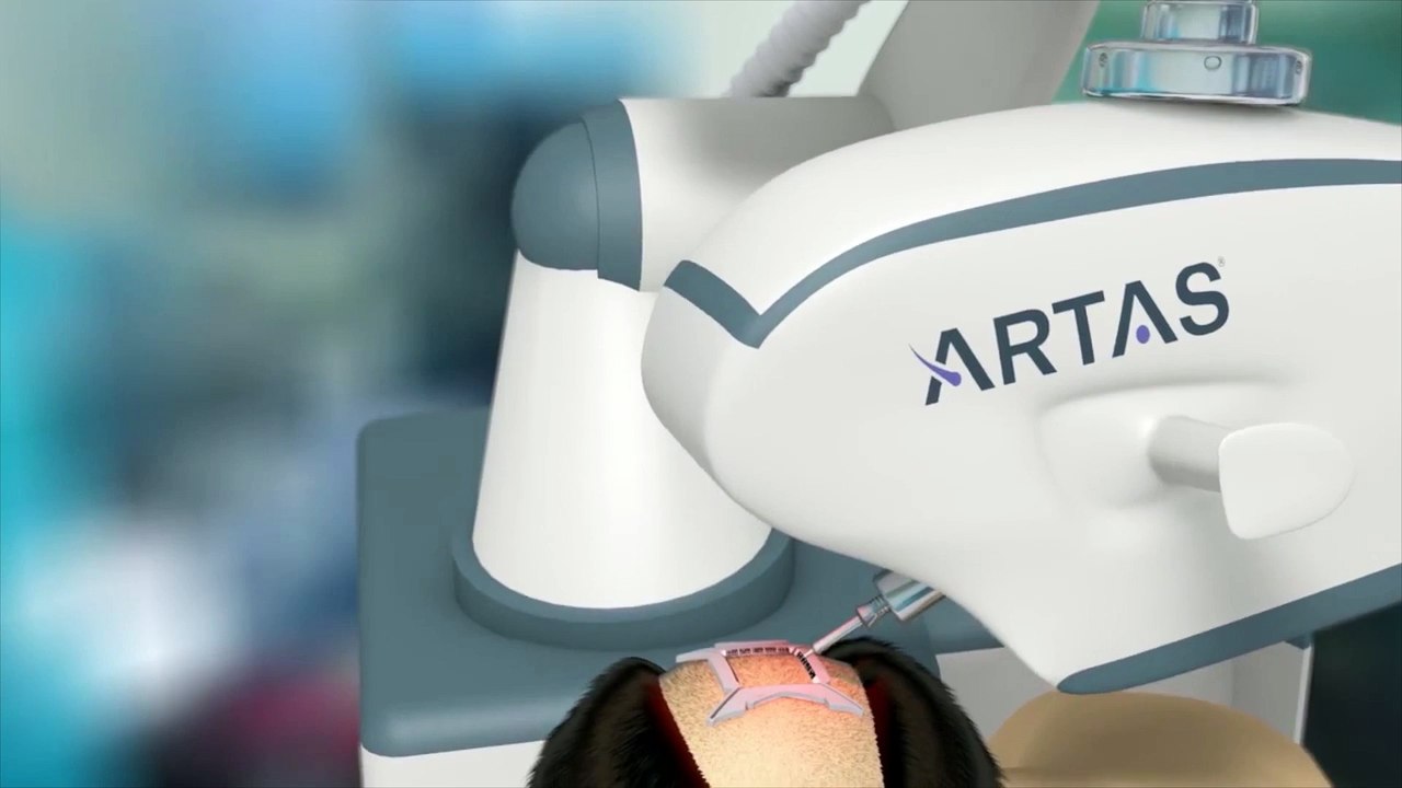 Présentation du robot ARTAS par le Dr Claude AHARONI