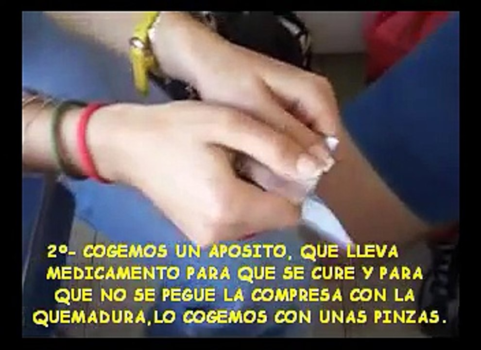 Video De Primeros Auxilios Quemaduras: cómo actuar ante una quemadura normal