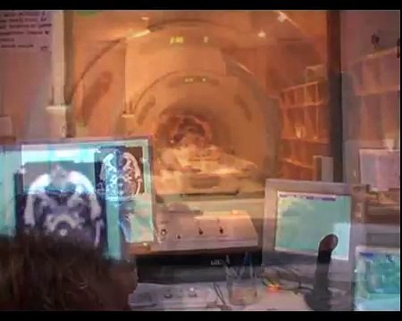 Métodos diagnósticos-Resonancia magnética