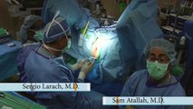 SILS™ Transanal Minimally Invasive Surgery: Patient Position