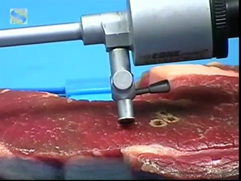 minimal access electrosurgery principles