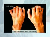 Hands and Wrists Physical Examination