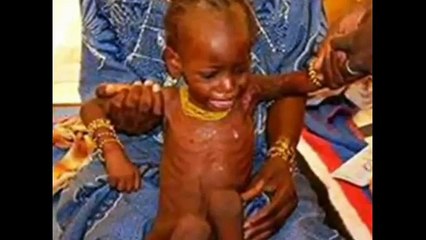 WHY FAMINE? IN THE HORN OF AFRICA IS THIS NOT THE 21 CENTURY OR WHAT?