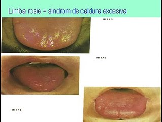 Cancer hepatic tratament naturist