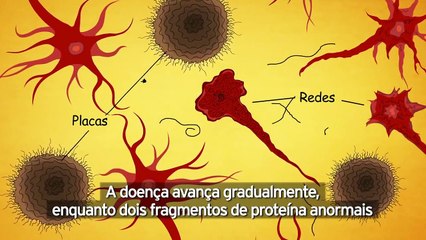 O que é a doença de Alzheimer? (legendas em português)