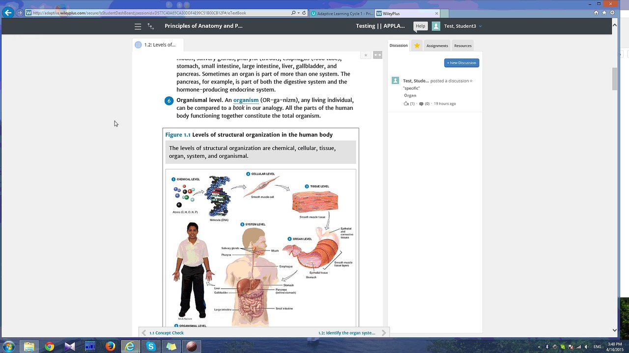 anatomy IS - no issue