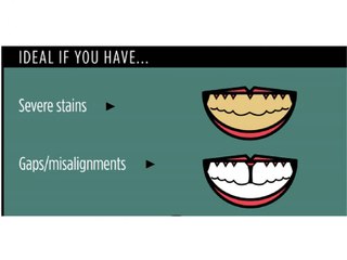 Affordable dental implant India