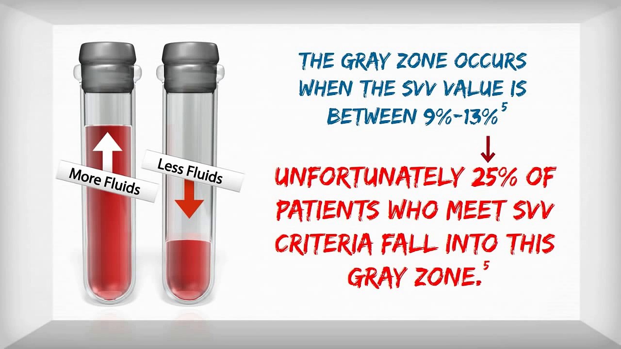 Stroke Volume Variation (SVV) Facts