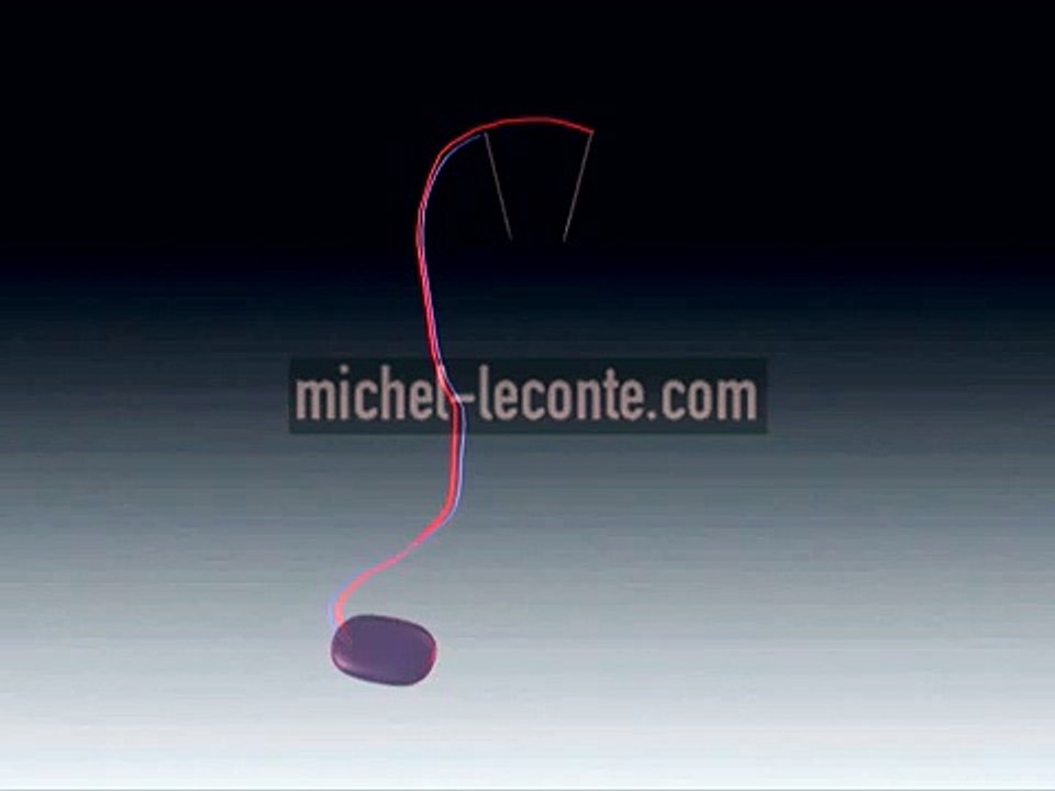 DEEP BRAIN STIMULATION, DBS, PARKINSON, EPILEPSY